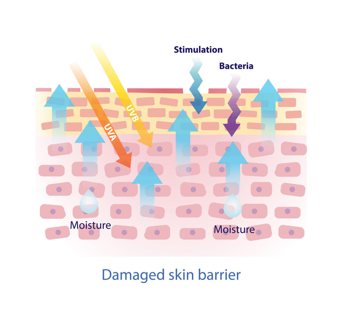Why Your Skin Barrier Is Secretly Damaged (And How To Fix It) ?